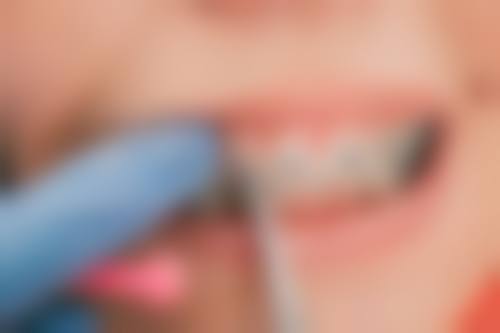 儿童矫正牙齿，拔牙与否有何不同？