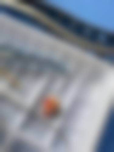 不同拔牙情况对漱口时间的影响