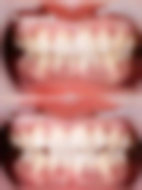 春珍齿科收费标准