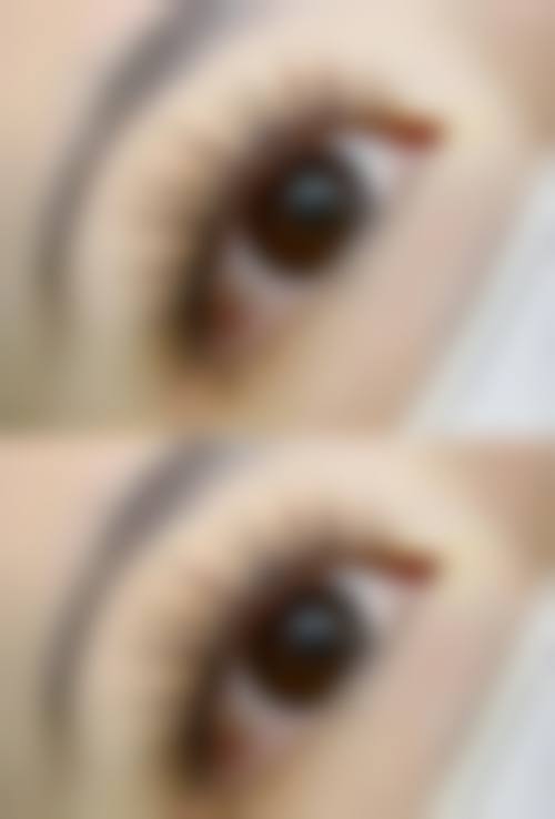 五、广州天河区史云逊植发医院收费价格表