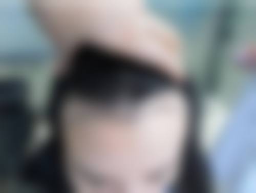 七、广州天河区史云逊植发医院预约挂号方式及流程