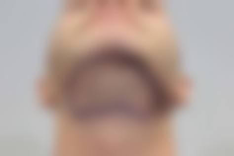 三、广州天河区史云逊植发医院地址电话营业时间