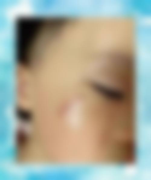 八、温州东华医院整形外科预约挂号方式及流程