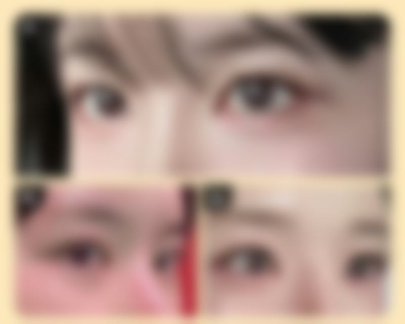 五、韩国Planner医院李東畇医生简介