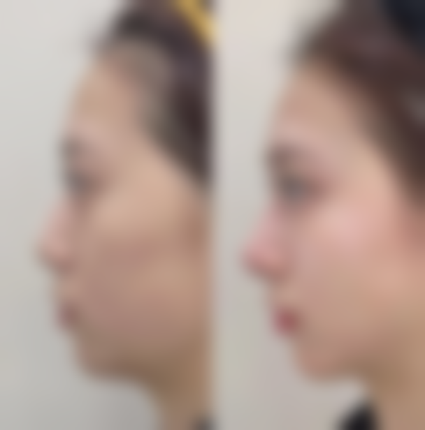 四、滕州滕化医院特色项目及技术优势