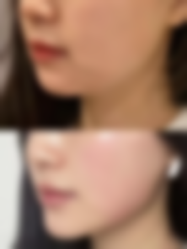 二、赣州田美整形医院是正规医院吗？