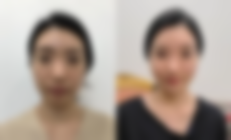 六、徐州力信医疗美容医院口碑怎么样？