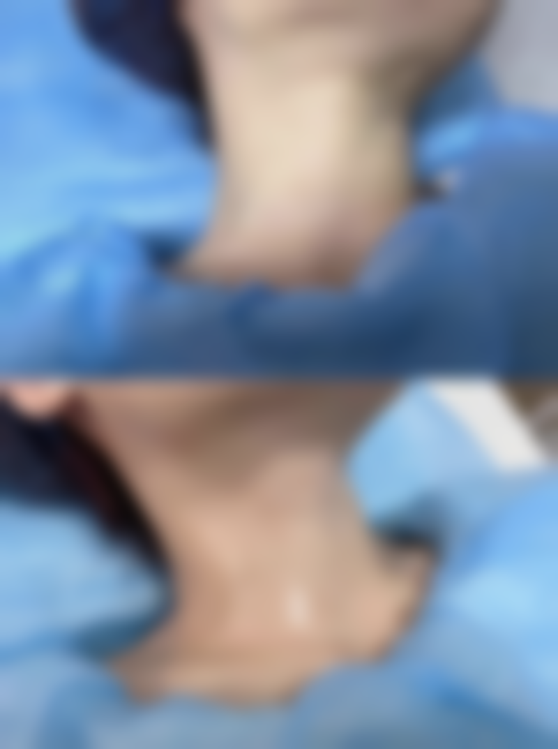 六、武警四川总队医院烧伤整形科口碑怎么样？