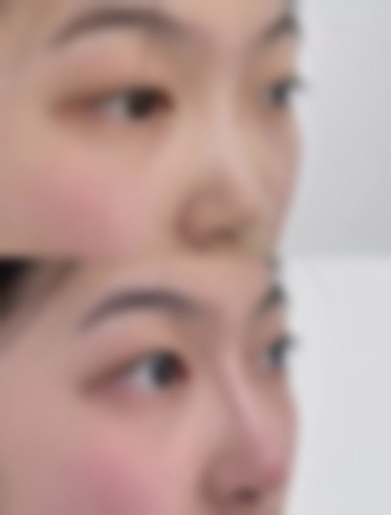 四、郑州市第一人民医院整形美容科特色项目及技术优势