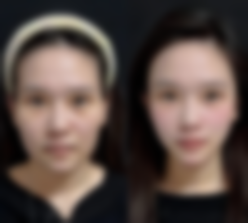 四、昆明唯美医疗美容诊所特色项目及技术优势