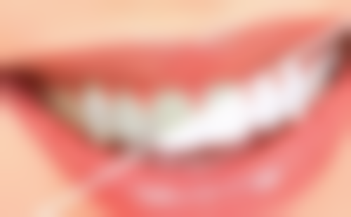 烤瓷或全瓷牙冠：多数情况需拆冠施治