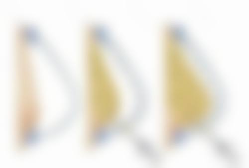 王茂荣医生技术优势