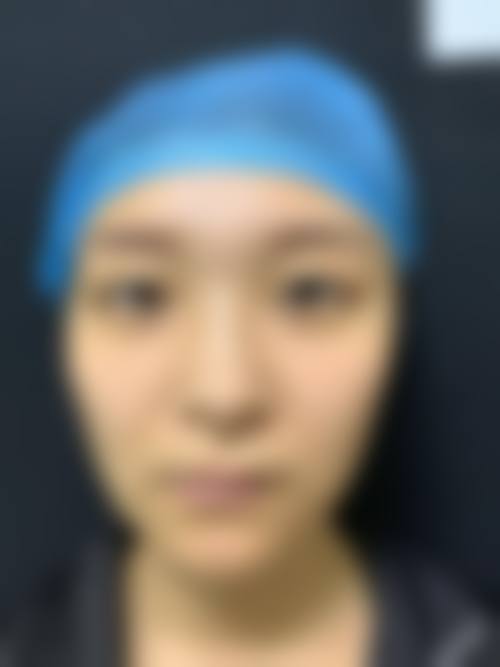 刘长松医生技术优势