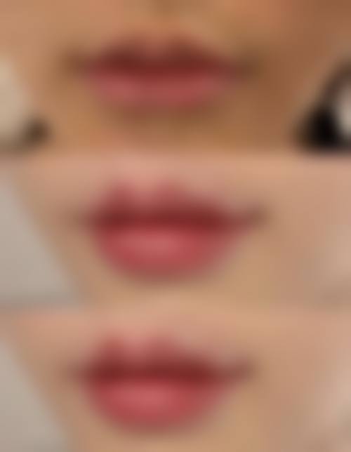 李東畇医生真人实例