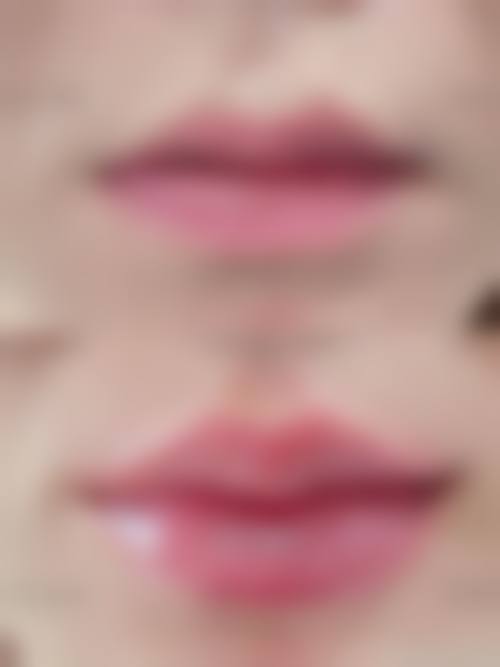 李東畇医生技术优势