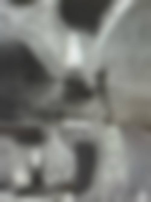 种植牙的五大危害，都是可规避的人为风险，选正规医院+经验医生才是避坑关键