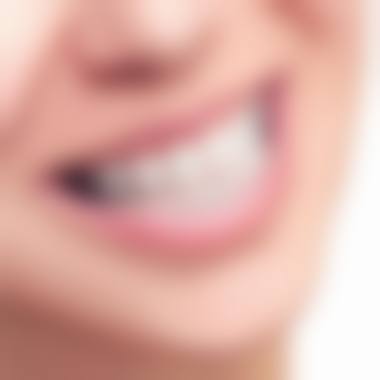 {秦皇岛隐形矫正24小时在线咨询：可询时代天使价、京美口腔就诊详情