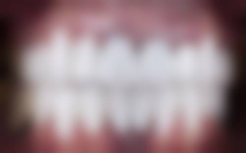 在线询问优势多