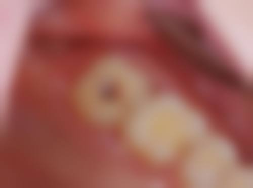 {德雅口腔地址｜覆盖西安广州深圳等城，附种植牙预约电话及收费参考