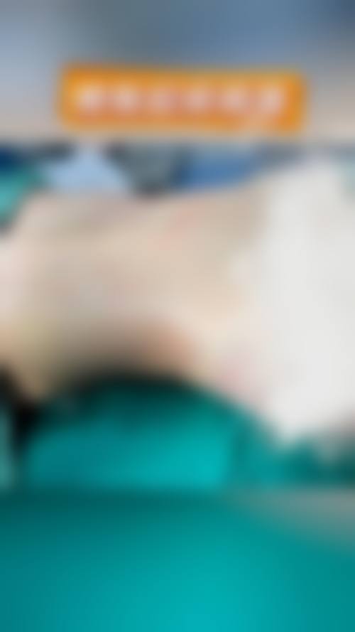 刘长松医生真人实例