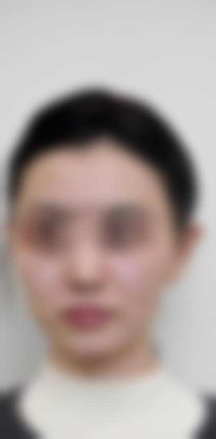 李東畇医生收费价格表