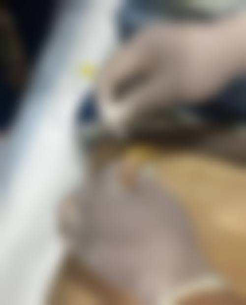 何彪医生擅长项目