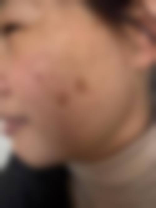 三、南通嘉佳美姿丽莱医疗美容门诊部特色项目及技术优势