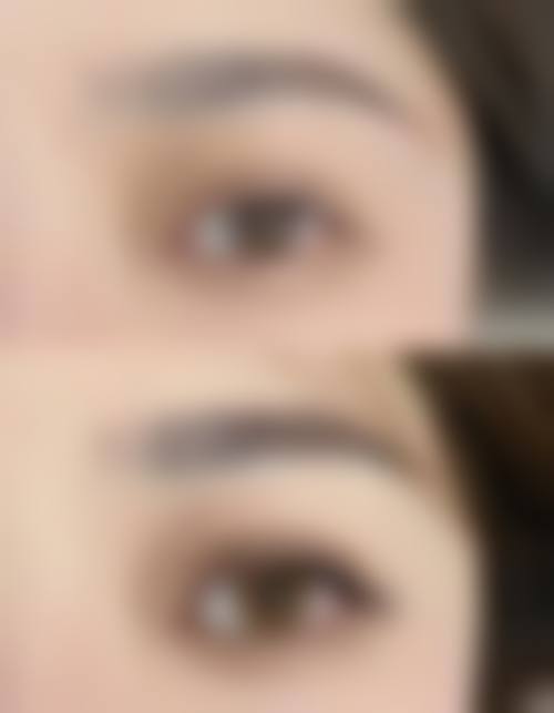 四、保定熙朵植发特色项目及技术优势