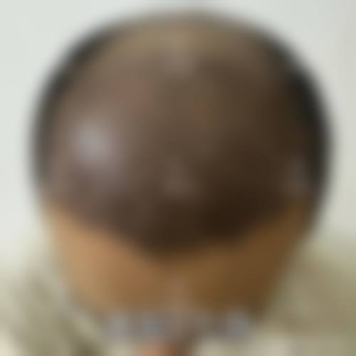 三、保定熙朵植发地址电话营业时间