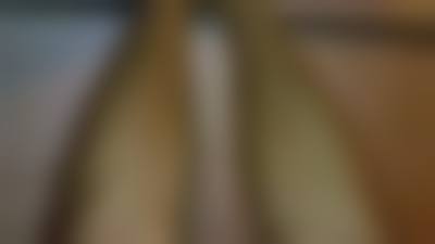 二、保定熙朵植发是正规医院吗？