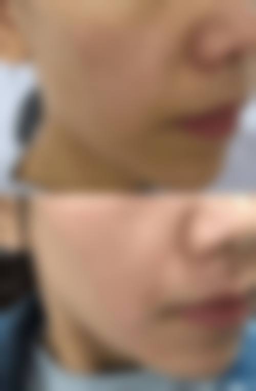 七、乳山奥美涵熙整形医院预约挂号方式及流程