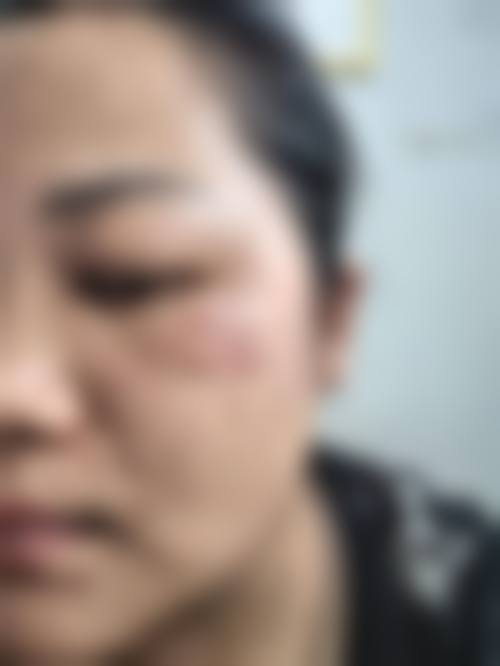 三、合肥铭医整形医院地址电话营业时间