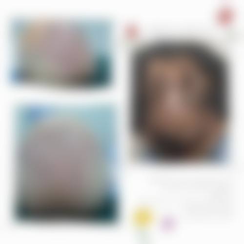 五、刘长松医生简介