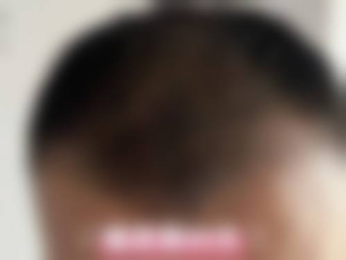 七、保定熙朵植发预约挂号方式及流程