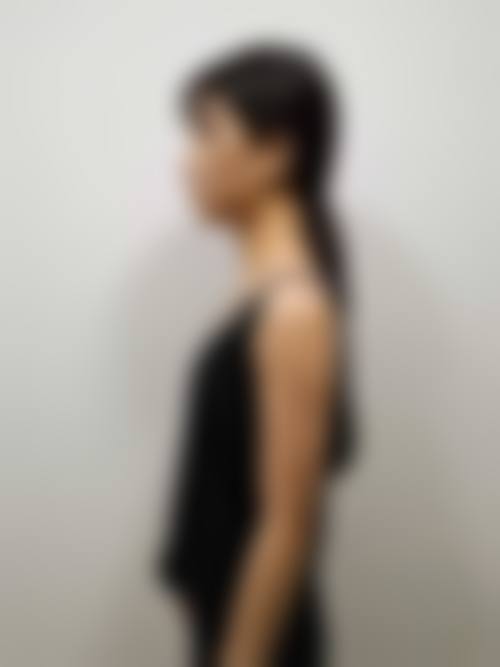 刘长松医生擅长项目