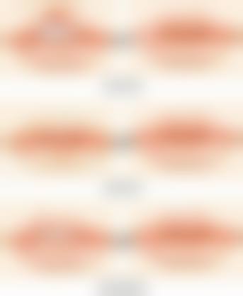 二、温州瑞亚医疗美容门诊部是正规医院吗？