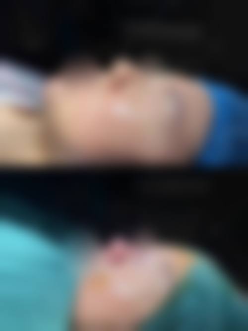 李禾德医生预约挂号