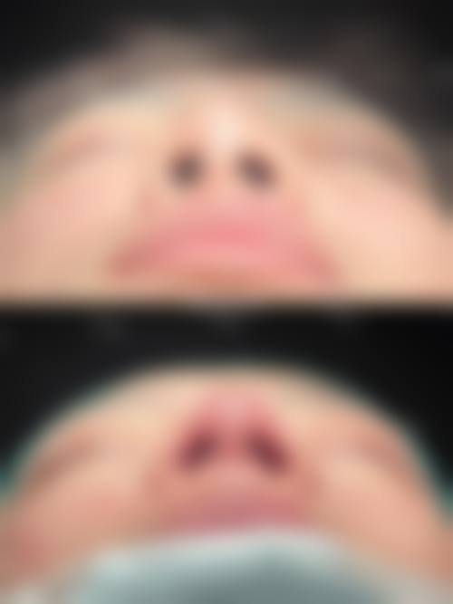 李禾德医生技术优势