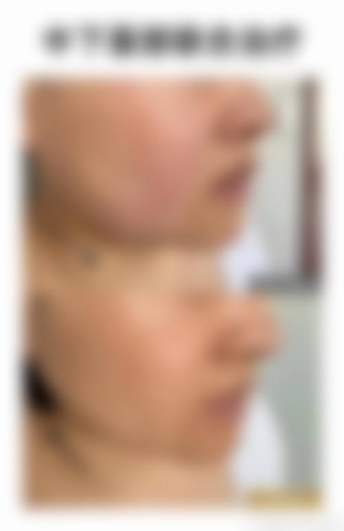 李東畇医生口碑评价