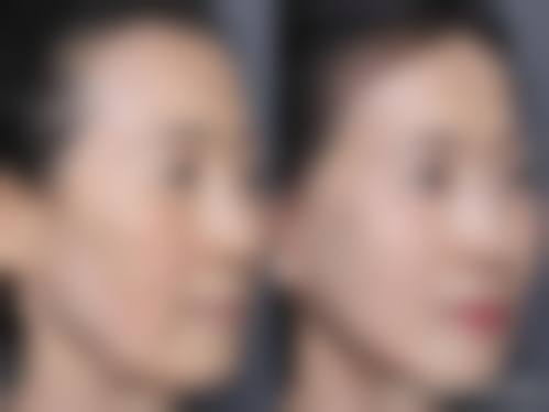 李禾德医生擅长项目