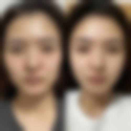 李東畇医生擅长项目