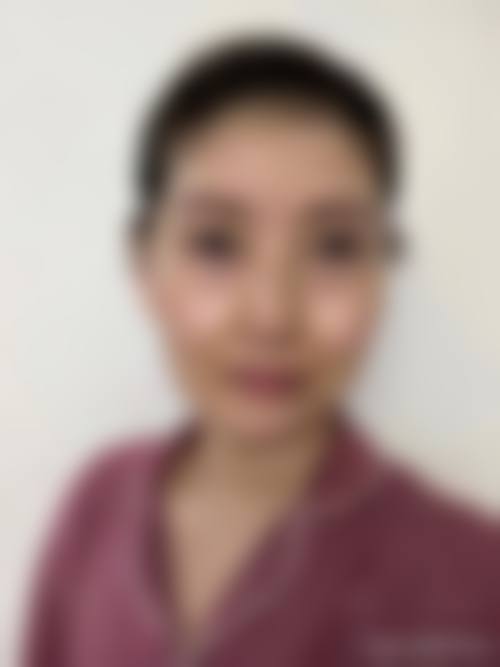 李禾德医生真人实例