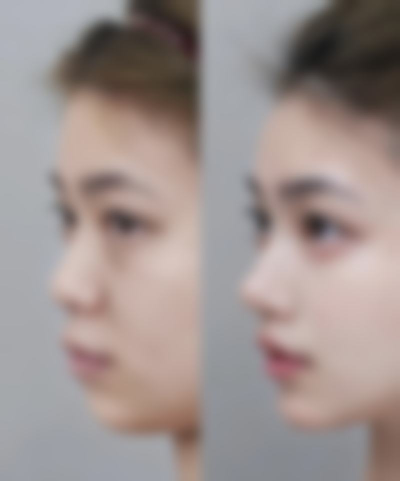 谢慧慧医生真人实例