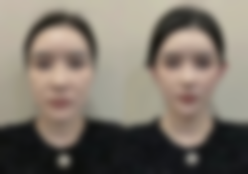 李東畇医生坐诊医院