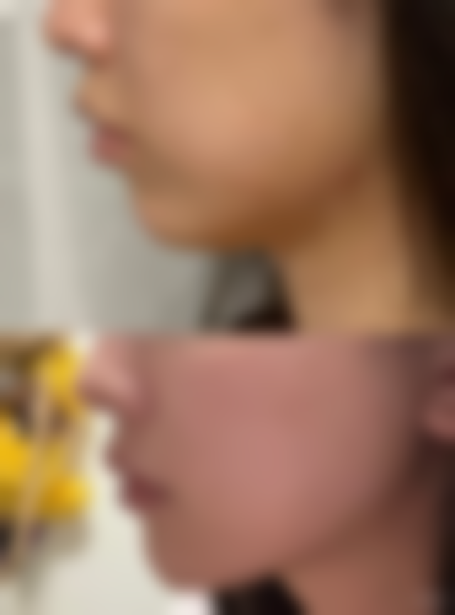 二、无锡半岛医疗美容是正规医院吗