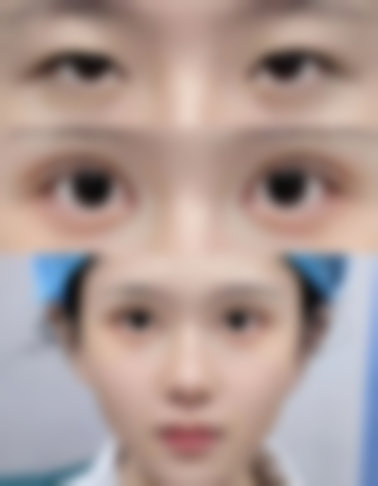 二、合肥铭医整形医院是正规医院吗？