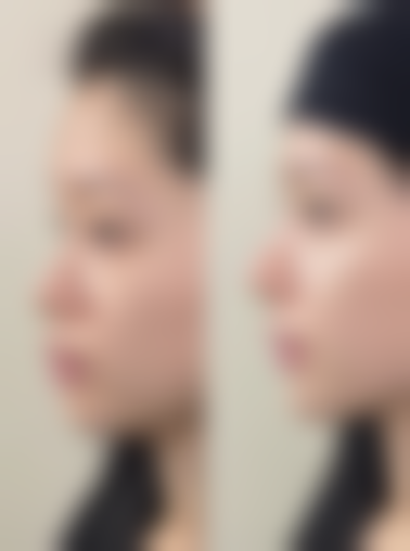 六、温州瑞亚医疗美容门诊部收费价格表