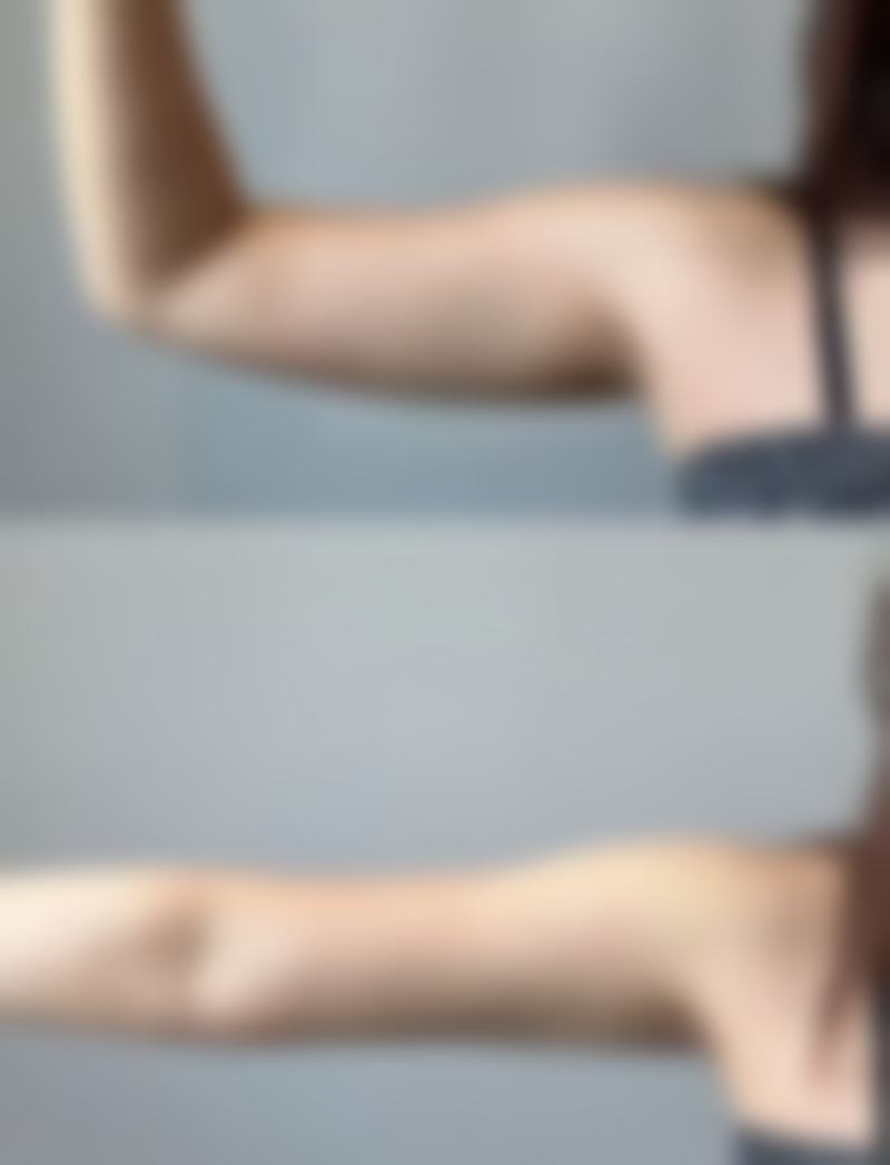 二、乳山奥美涵熙整形医院是正规医院吗