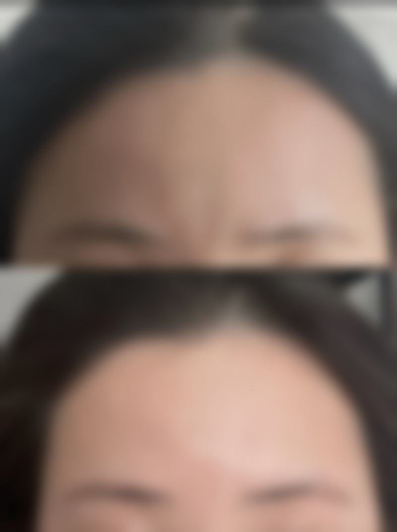 谢慧慧医生擅长项目