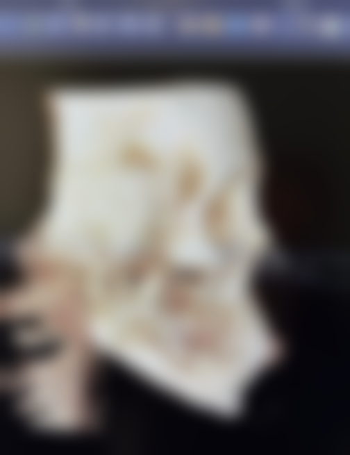 王茂荣医生技术优势